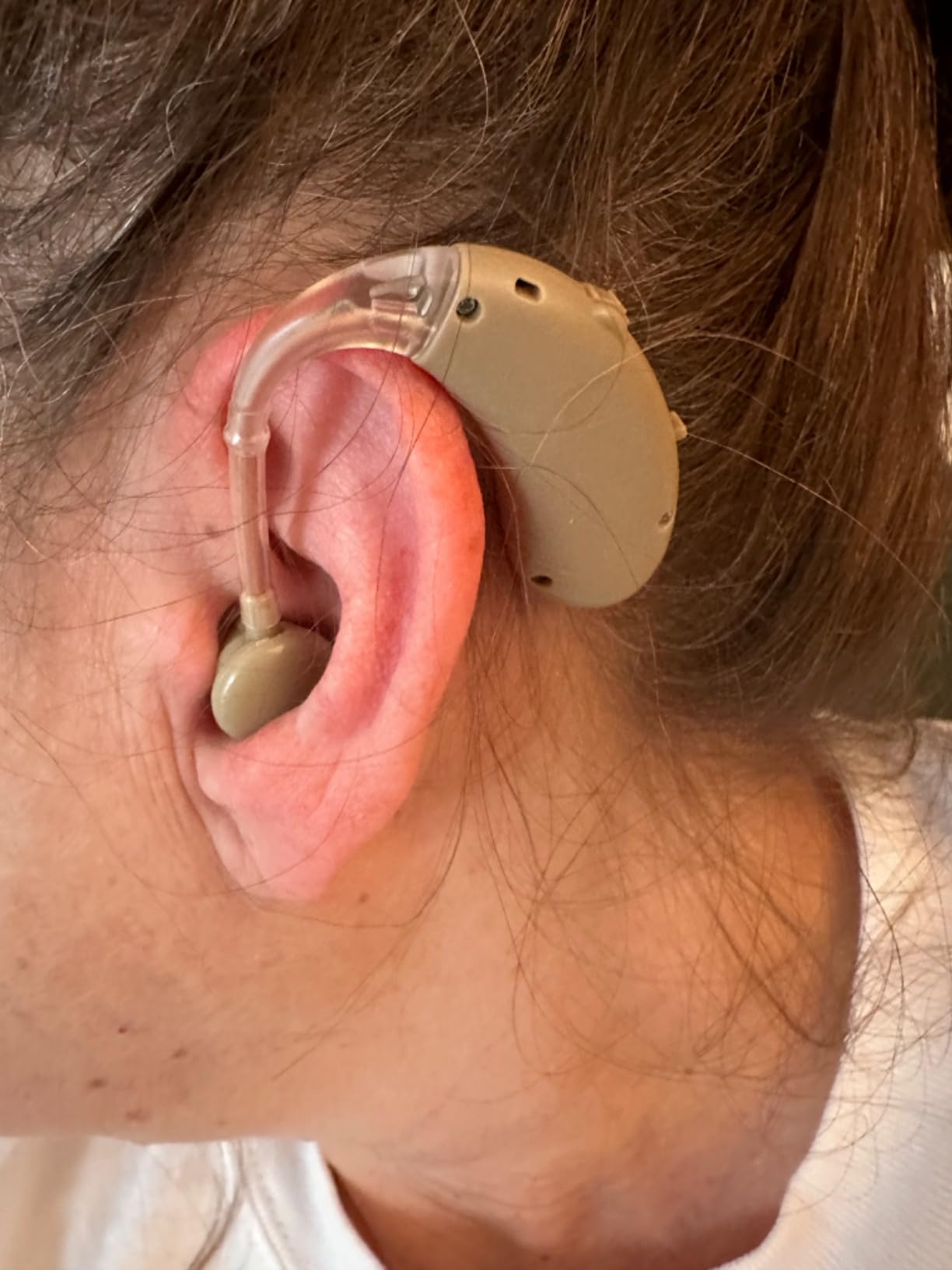 Hearing Aids for Seniors Rechargeable with Noise Canceling, Hearing Amplifier for Adults, Sound Amplifier for Hearing Loss - in Ear - with Volume Control customer photo 2